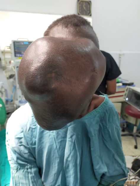 Beatrice Makokha; the woman who had a huge cyst on her forehead.